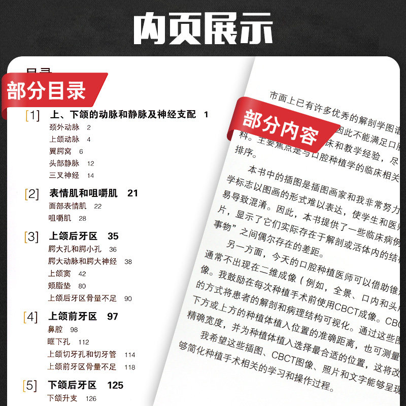 正版 口腔种植相关外科及放射线解剖 口腔种植学正畸学医学类专业书籍 辽宁科学技术出版社 9787559111111 牙齿种植手术技巧指导书