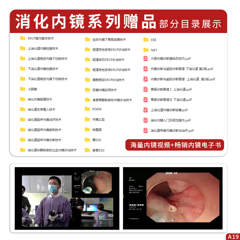 放大胃镜+放大内镜胃早癌诊治集锦+放大胃镜诊断图谱 正版3本消化内镜学书籍胃镜学标准检查图谱放大胃镜观察技巧早期胃癌诊断标准 - 图0