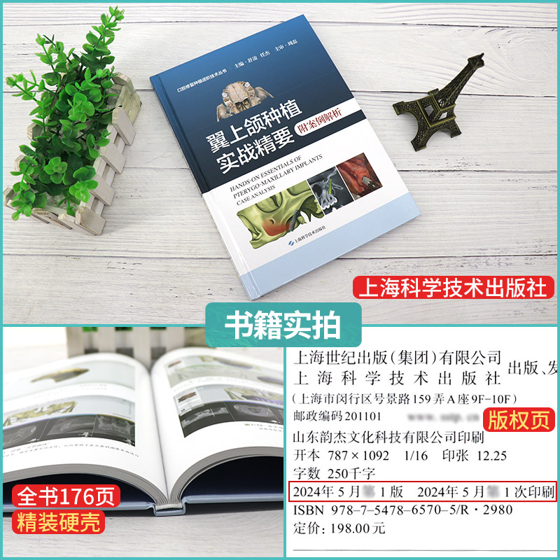 包邮正版 翼上颌种植实战精要 附案例解析 舒凌 任杰 主编 上海科学技术出版社 适合口腔种植科医师阅读 上颌磨牙区垂直骨高度不足