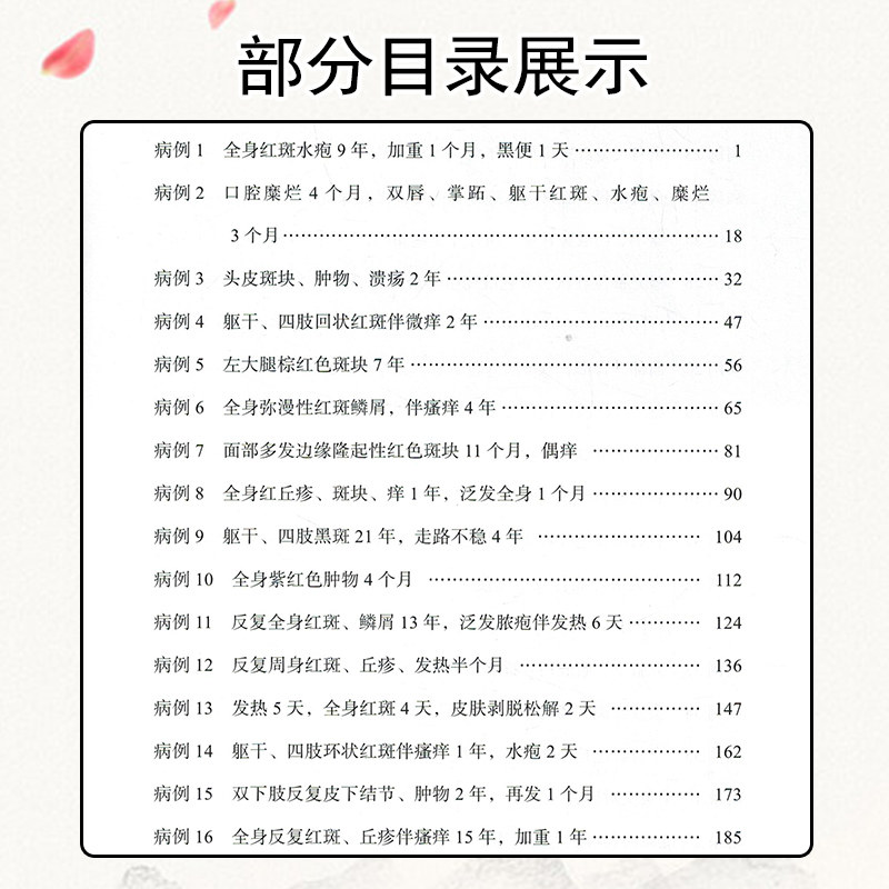 北京协和医院疑难重症皮肤病自身 久久旺图书皮肤病学/性病学