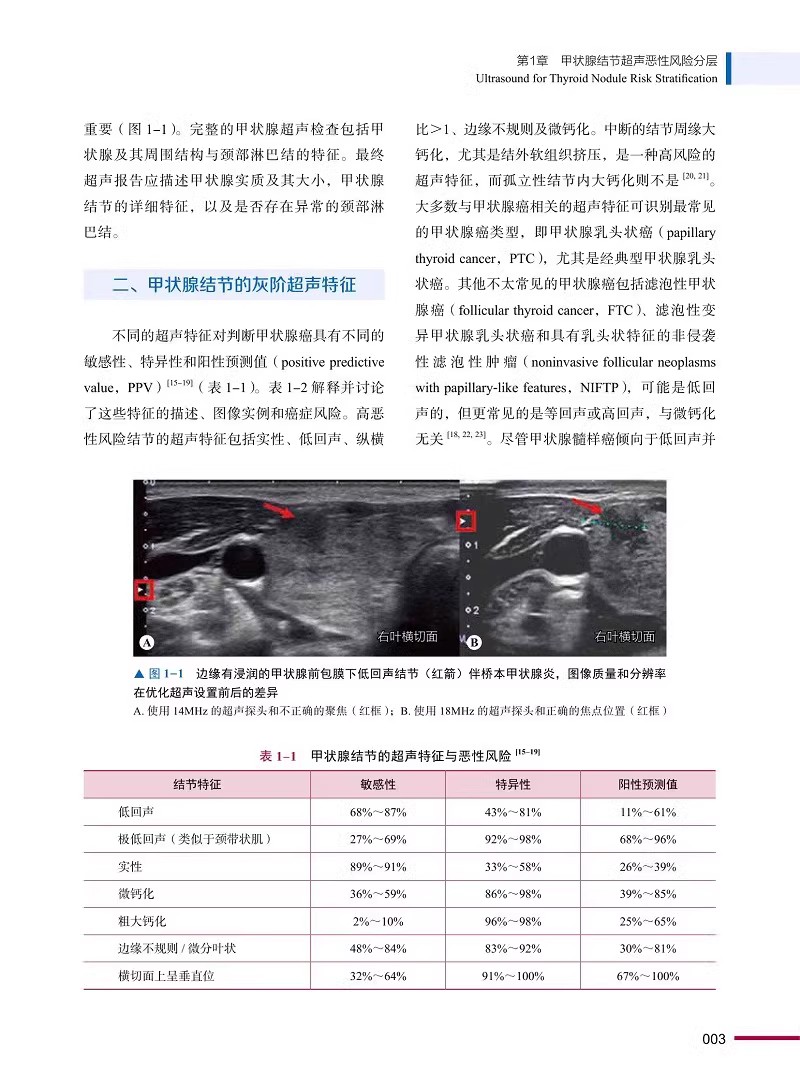 现代内分泌外科创新 吴宇 主译 甲状腺结节超声诊断 等 适合国内甲状腺外科及相关医师阅读参考 中国科学技术出版社9787523601037 - 图2