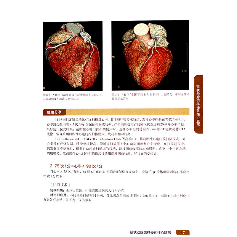 心血管疾病CT扫描技术 附增值服务 陈险峰 李林 马小静主编 9787117254977 影像医学 人民卫生出版社 医学书 - 图2