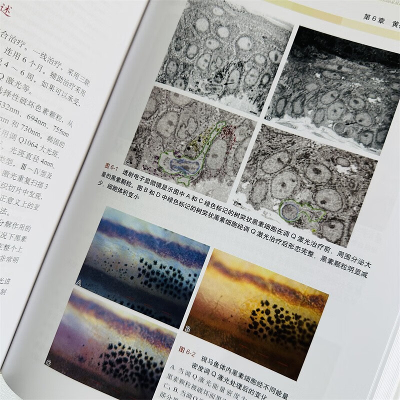 黄褐斑临床诊疗 苑凯华周国瑜皮肤结构及生理病理色素代谢机制黄褐斑基础总论和黄褐斑临床总论联合临床治疗方案书籍 科学出版社