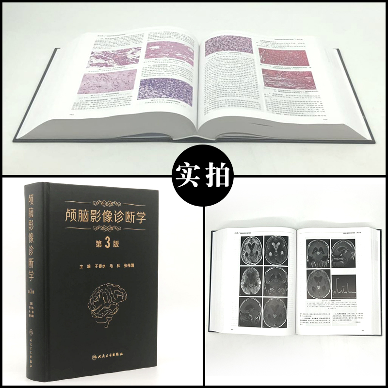 正版颅脑影像诊断学第3版第三版于春水马林张伟国主编脑病影像诊断医学影像科神经内科精神科神经放射学人民卫生出版社-图0