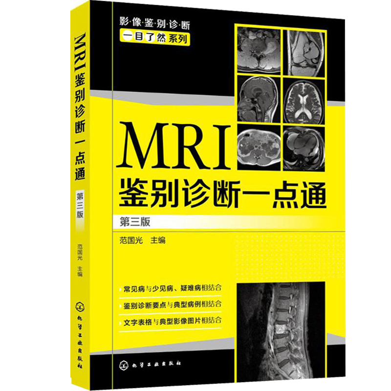 3本 MRI鉴别诊断一点通第3版+实用临床MRI诊断图解第二版+MRI诊断报告书写技巧mri读片指南mri诊断手册核磁共振成像图解报告诊断学-图2