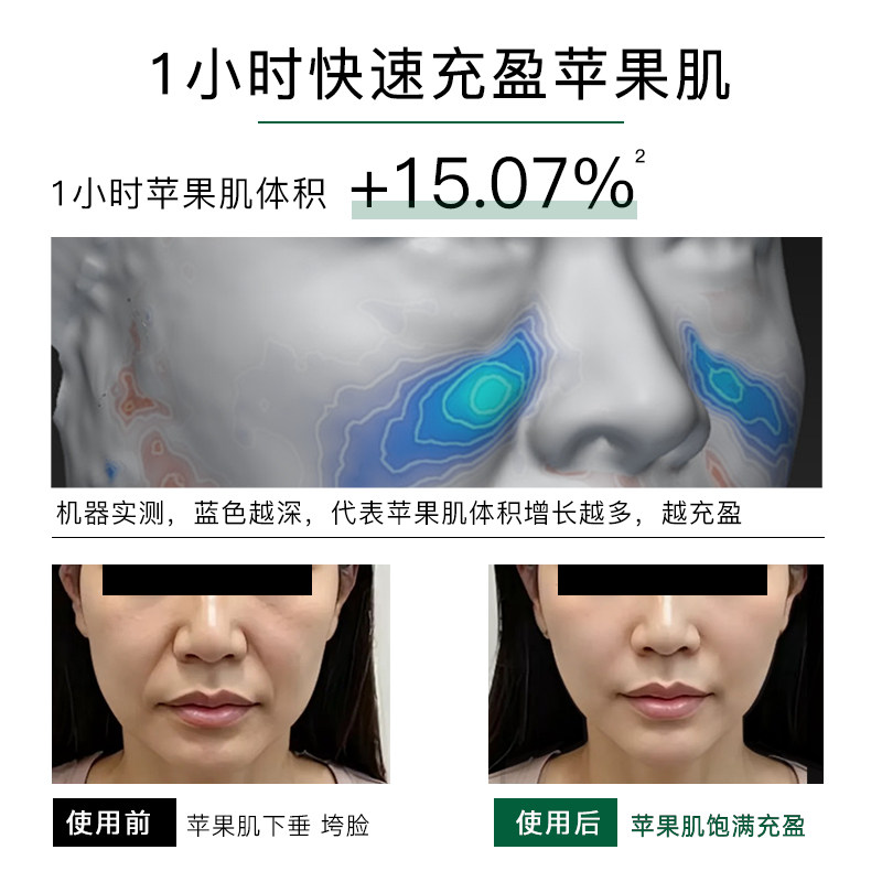 德国佰奥德BIOMD焕龄时光童颜油30ml面部K皱淡纹紧致提亮抗光老 - 图0
