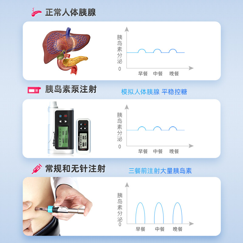 丹纳(dana-iis/r)进口便携胰岛素泵 旭映医疗器械血糖用品