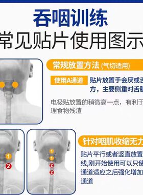 康骏宏吞咽训练康复仪中风偏瘫