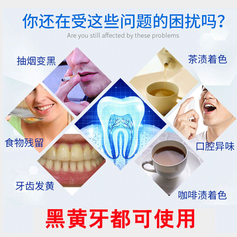正品牙斑净牙齿美白洗牙去黄牙垢烟渍黑黄速效白牙素牙班神器洗白