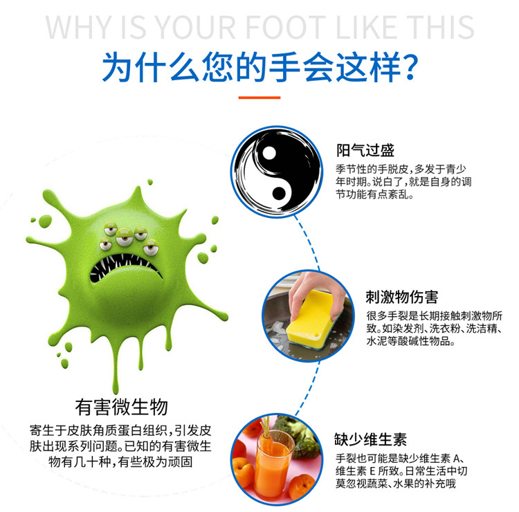 手气爽手痒治手裂口干裂修复霜季节性脱皮止痒药膏起水泡护手霜_虎窝淘