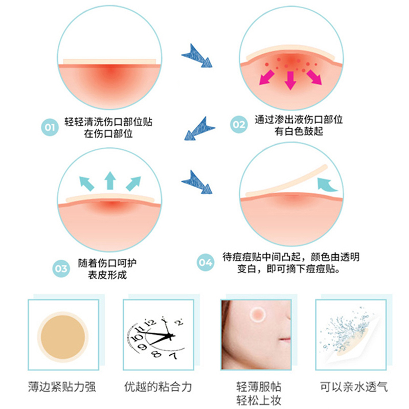 常小辉 韩国olive young隐形痘痘贴炒薄急救贴青春痘贴痘贴102贴 - 图0