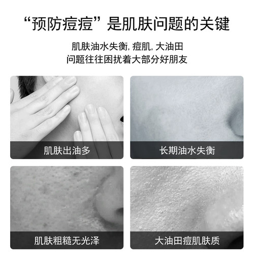 康芙美清痘控油凝露50ml痘痘印清理毛孔光滑控油祛痘 - 图1