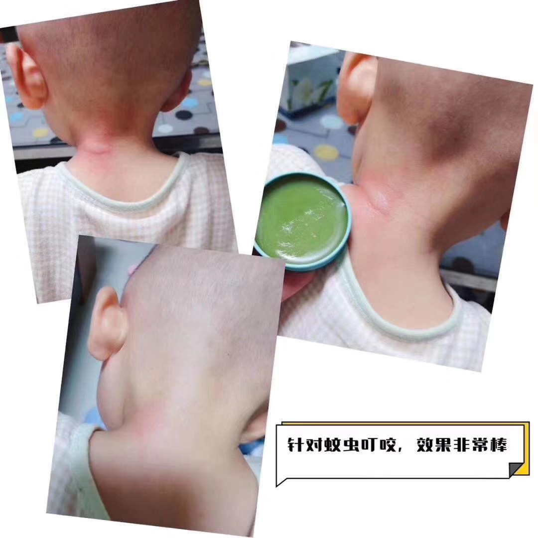 SOLOVE米菲婴儿童多效植物修复膏孕妇宝宝驱蚊消包止痒红pp紫草膏,淘宝优惠券,粉丝福利购,淘宝优惠卷