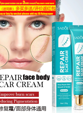 fadeScarCreamRepair祛疤面霜