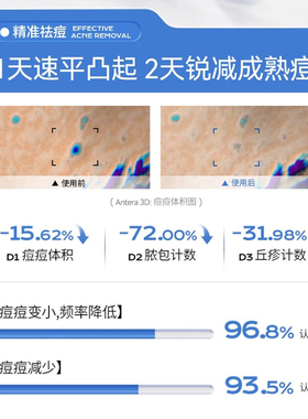 1天瘪痘 隐形隔离~Stridex施颜适水杨酸痘痘贴超薄祛痘舒缓控油