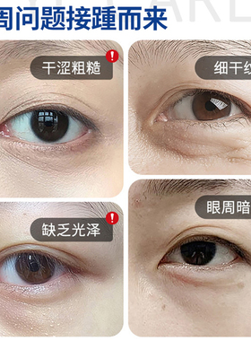 芮俏B5眼部护理霜淡纹祛黑眼圈