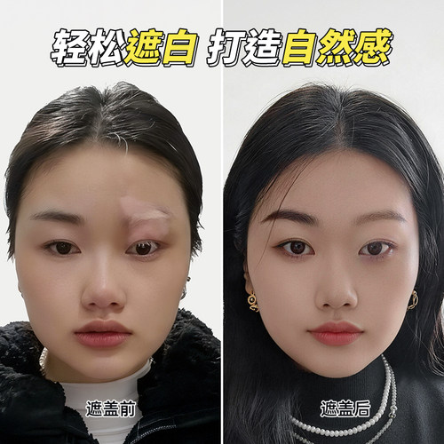 盖百霖白癜风遮盖液 白斑遮盖液笔 遮盖液白癜风遮盖神器霜剂 - 图2