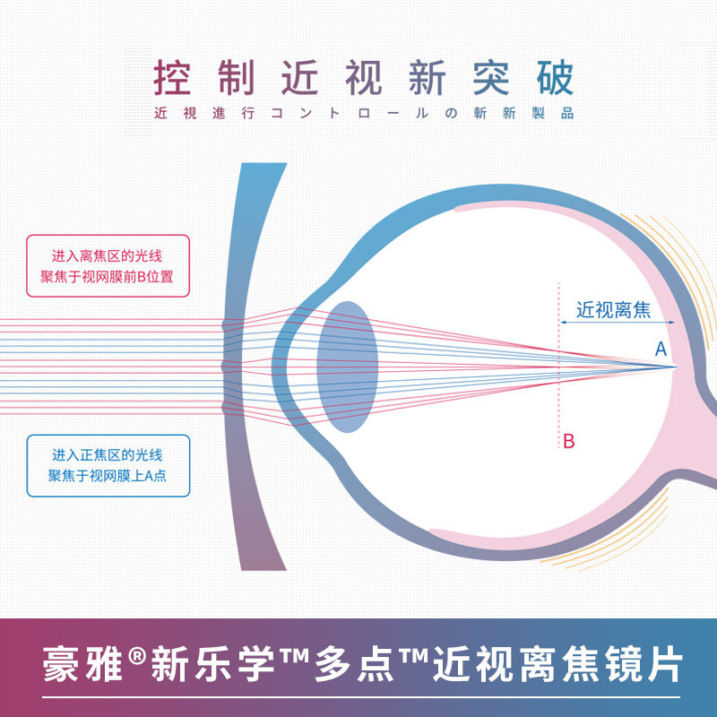 hoya豪雅新乐近视延缓学生镜片1.59多焦点离焦度数眼镜片非球面