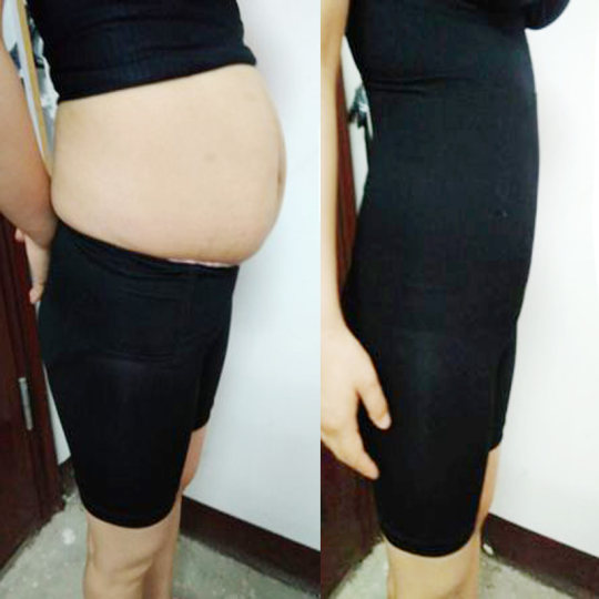 哺乳吊带款产后收腹塑身衣分体套装收腹神器孕产妇束身透气塑身衣