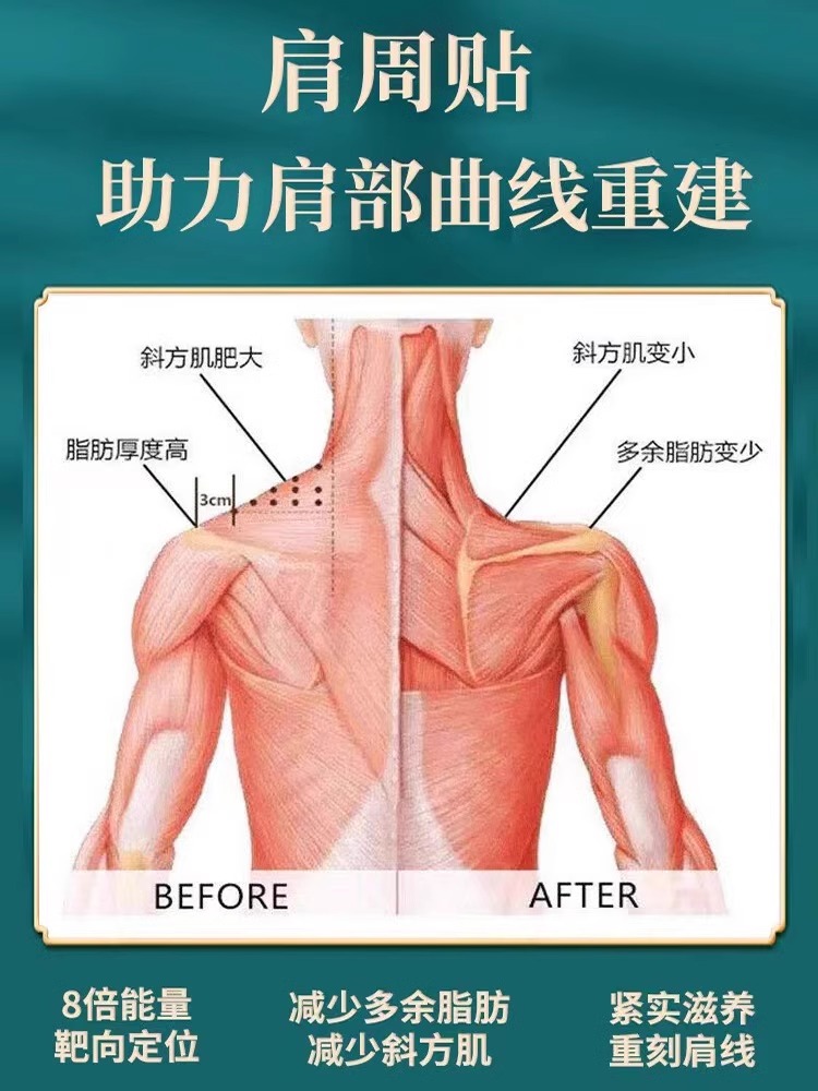 斜方肌消除神器美肩神器瘦肩薄背女神远离肉厚直角肩膀贴 - 图1