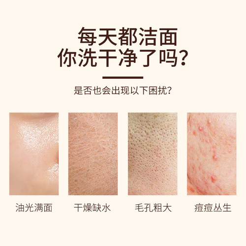 老中医痘清洗面奶温和祛痘深层清洁青春痘闭口粉刺黑头官方旗舰店 - 图1