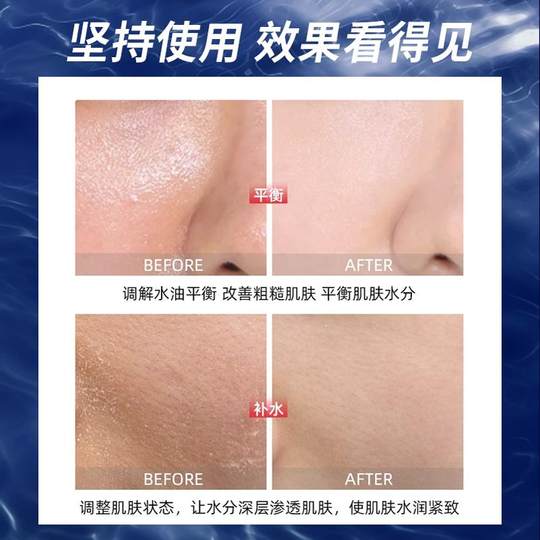 Details page to receive gold coins at a surprising price for uno facial cream