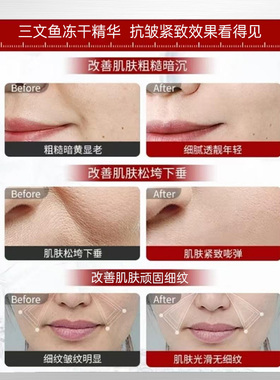 DEKREI瑞士本土高端院线专研三文鱼NAD+浓缩抗皱淡纹冻干双舱精华