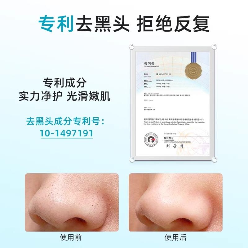 ilso鼻贴去黑头粉刺闭口导出液改善毛孔男士专用套装官方正品女-图2
