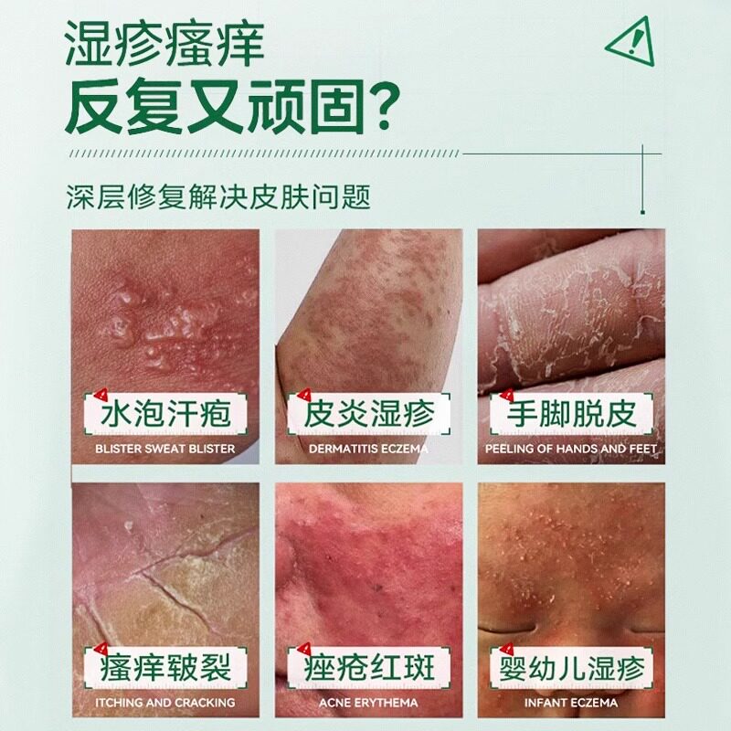 葵花医用皮肤敷料非修复皮炎湿疹护理喷雾官方旗舰店2er