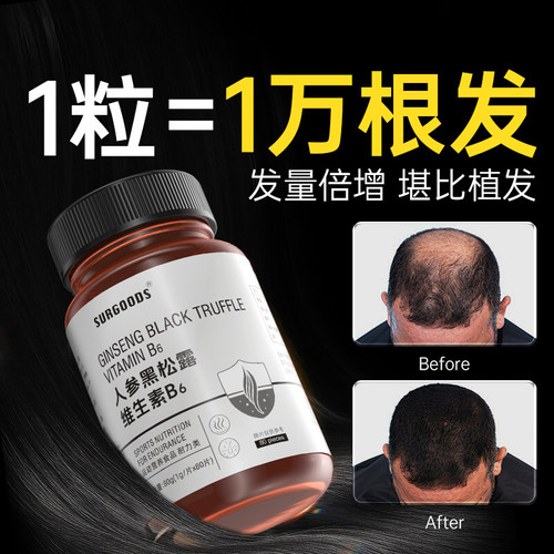 维生素b6防脱发生发生物素hb7复合vb族片掉头发严重吃什么叶酸nx - 图0