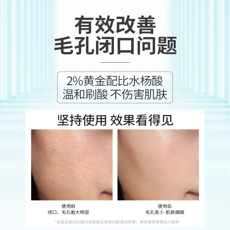 资莱皙旗舰店水杨酸爽肤水正品刷酸去闭口粉刺淡化祛痘印黑头收缩毛孔女男精华2