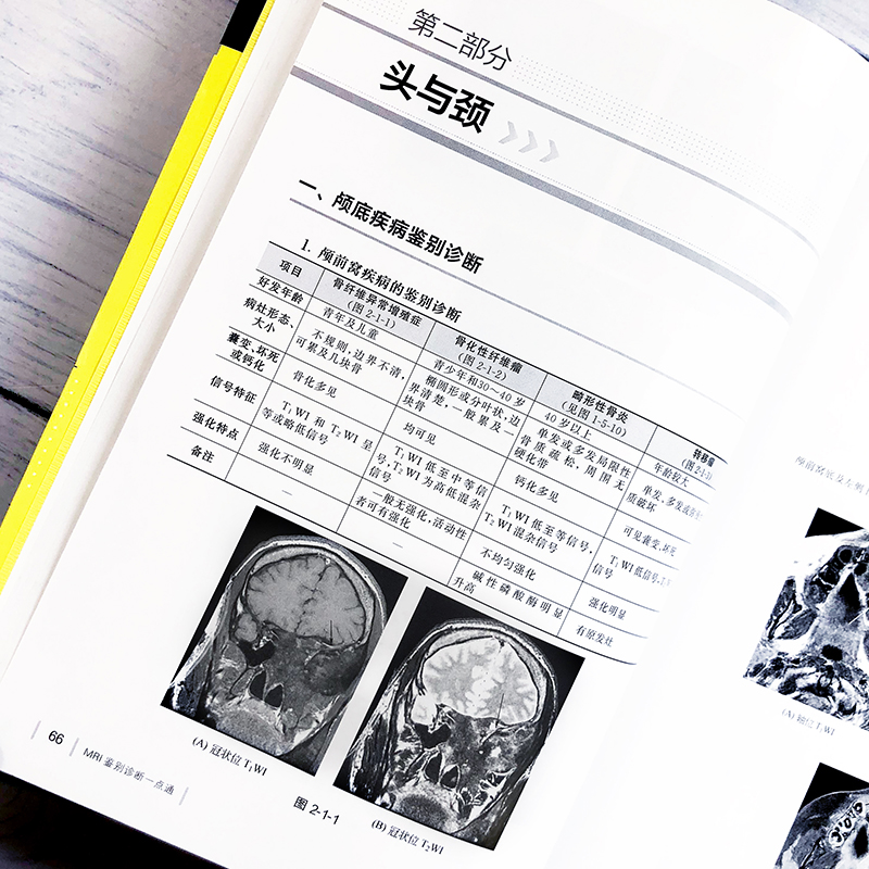 MRI鉴别诊断一点通 mri影像诊断mri诊断与临床mri基础mri检查技术医学影像诊断学医学影像学读片诊断图谱导图式医学影像鉴别诊断书-图0