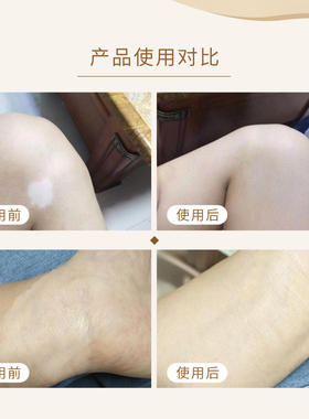 白斑遮盖棒膏自然持久便携立即