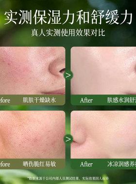 雅瑞欣舒缓芦荟凝胶补水保湿