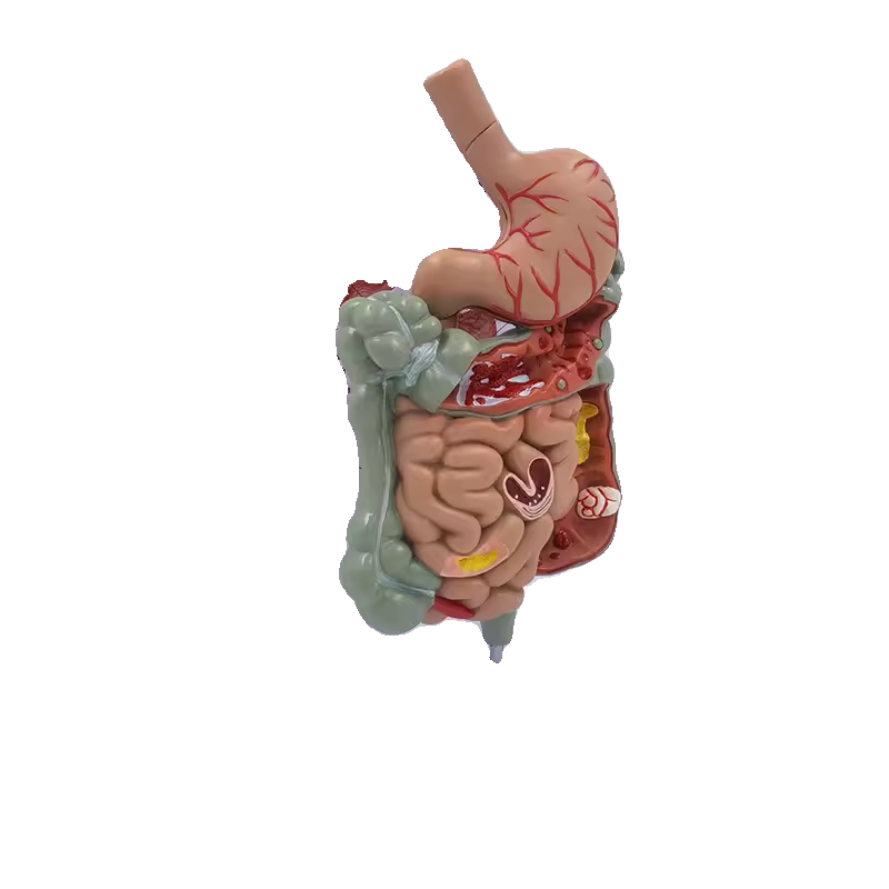 病理消化系统模型胃剖面大肠小肠解剖模型医学展示教学讲解科普-图3