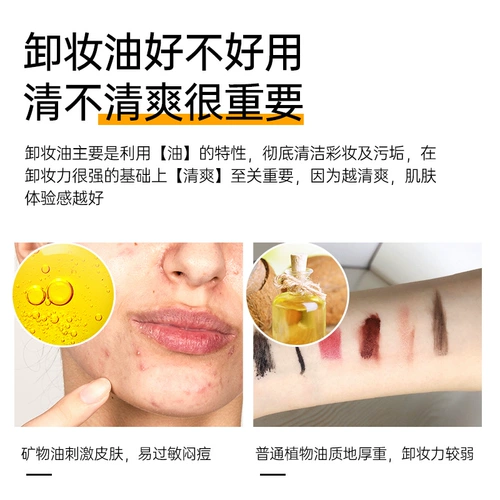 Средство для снятия макияжа для жирной кожи от черных точек, скрывает прыщи, официальный продукт