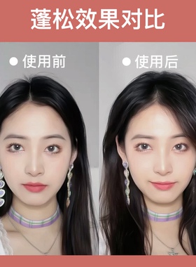 玉米烫夹板头发蓬松头顶造型发根玉米须板负离子不伤发高颅顶神器