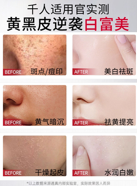 敷1次白1度！377美白淡斑面膜