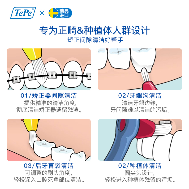 TePe进口牙套种植体专用矫正器牙间隙刷清洁牙齿软毛硬毛正畸牙刷