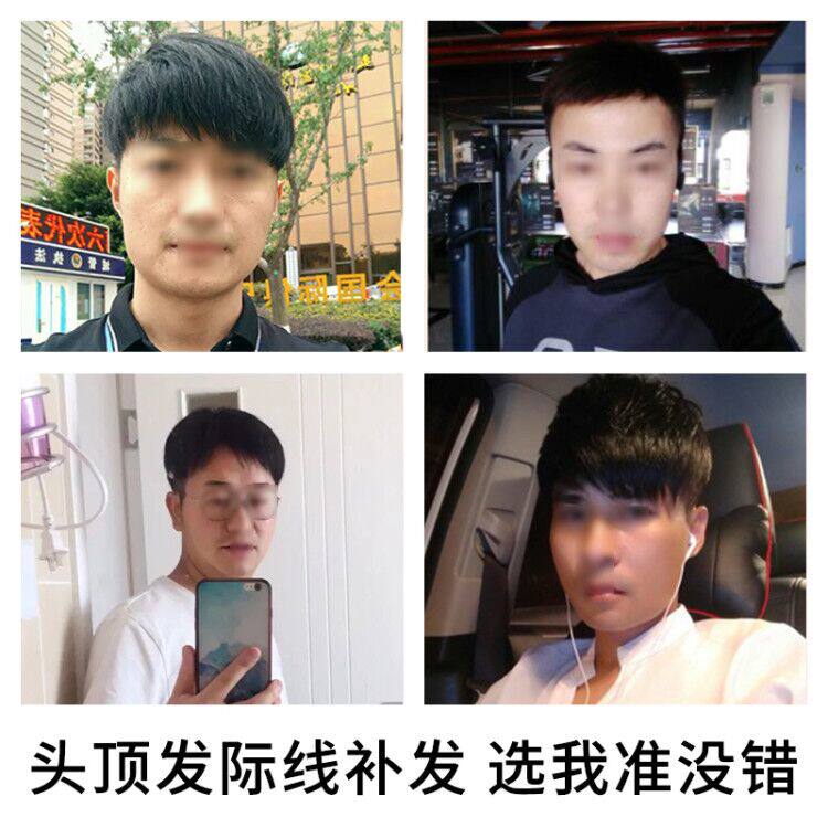 男韩版帅气头顶补发片无痕隐形假发 俏美假发整顶假发