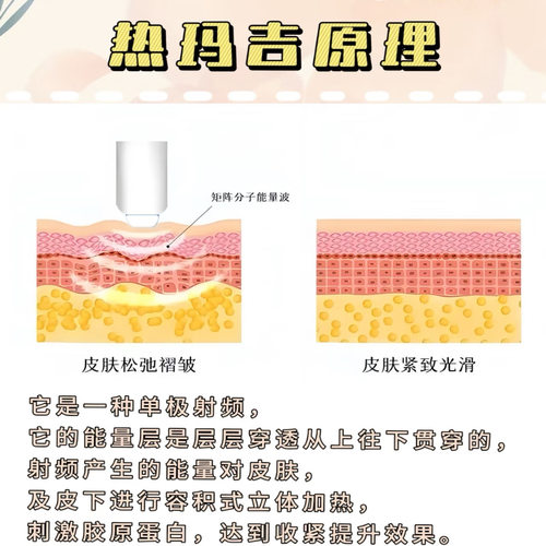 360度水光仪美容仪器脸部提拉紧致除皱波拉皮吉脸拉提瘦脸热玛 - 图2