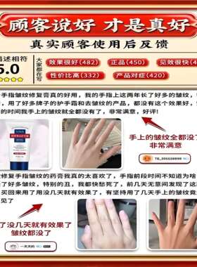 去手指关节皱纹祛除手粗糙干燥手背暗沉黑修复手纹护手霜保湿嫩肤