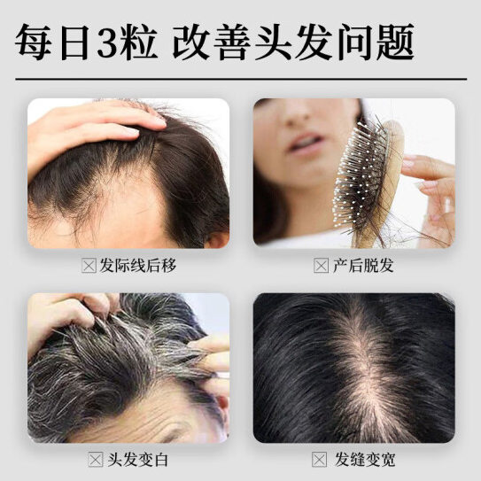 维特健灵乌丝素内服养发育发野生制何首乌黑白滋补食疗胶囊90粒瓶 - 图3