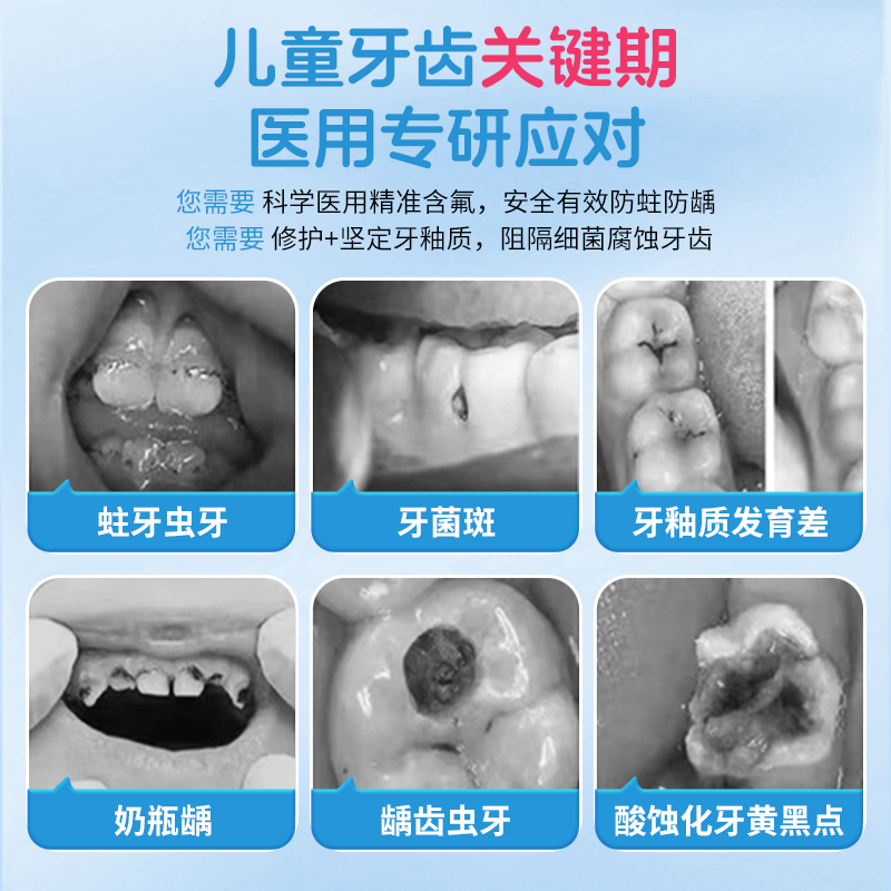 儿童牙膏0到3-6一12岁含氟防蛀固齿龋齿修复宝宝换牙期专用可吞咽 - 图1