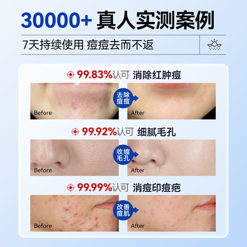 医用冷敷贴械准字号医美修复补水去痘淡化痘印收缩毛孔非面膜型 - 图3