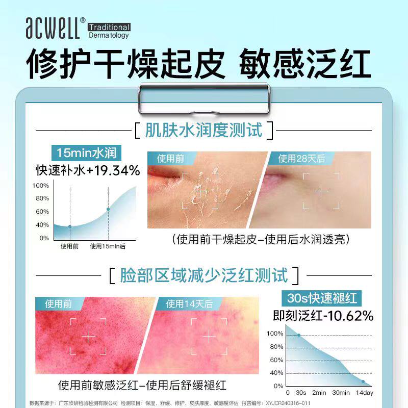 acwell艾珂薇N4面霜50ml补水滋润舒缓褪红油皮冬季清爽敏感肌急救