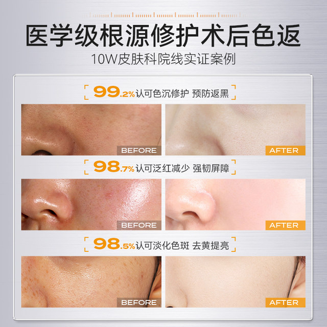 High concentration of Tengexyl acid essence High concentration of Tengexyl acid essence