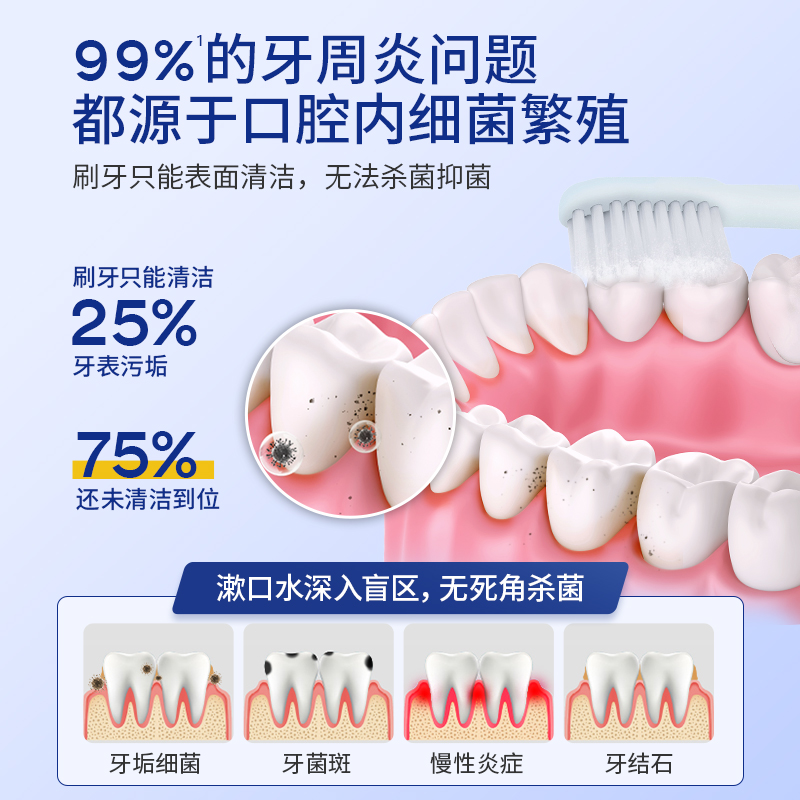 医用漱口水杀菌消炎牙周炎牙结石溶解漱口水牙龈萎缩儿童抗菌便携