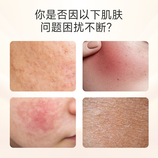 /Similar a la línea hospitalaria/Yiningmei apósito líquido para el cuidado de heridas 30ml cuidado superficial no crónico de la piel para heridas