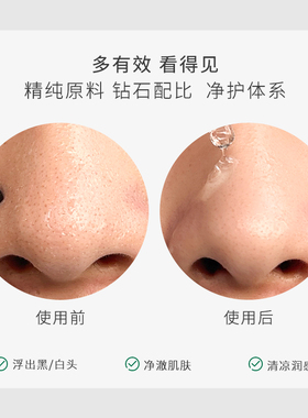 柏翠丝茶树去黑头导出液套装收缩毛孔清洁毛孔精华液28ml